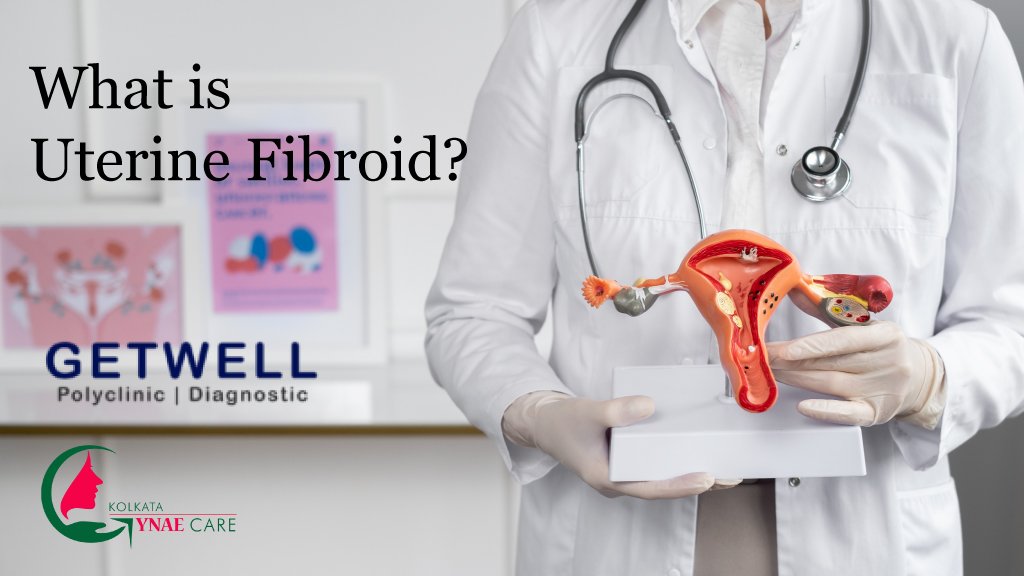 uterine fibroids treatment by Dr. Chandrani Pal ( one of the best gynaecologist in kolkata)